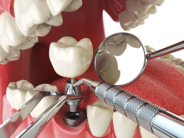 Best Broken Tooth Emergency  in Livingston, CA